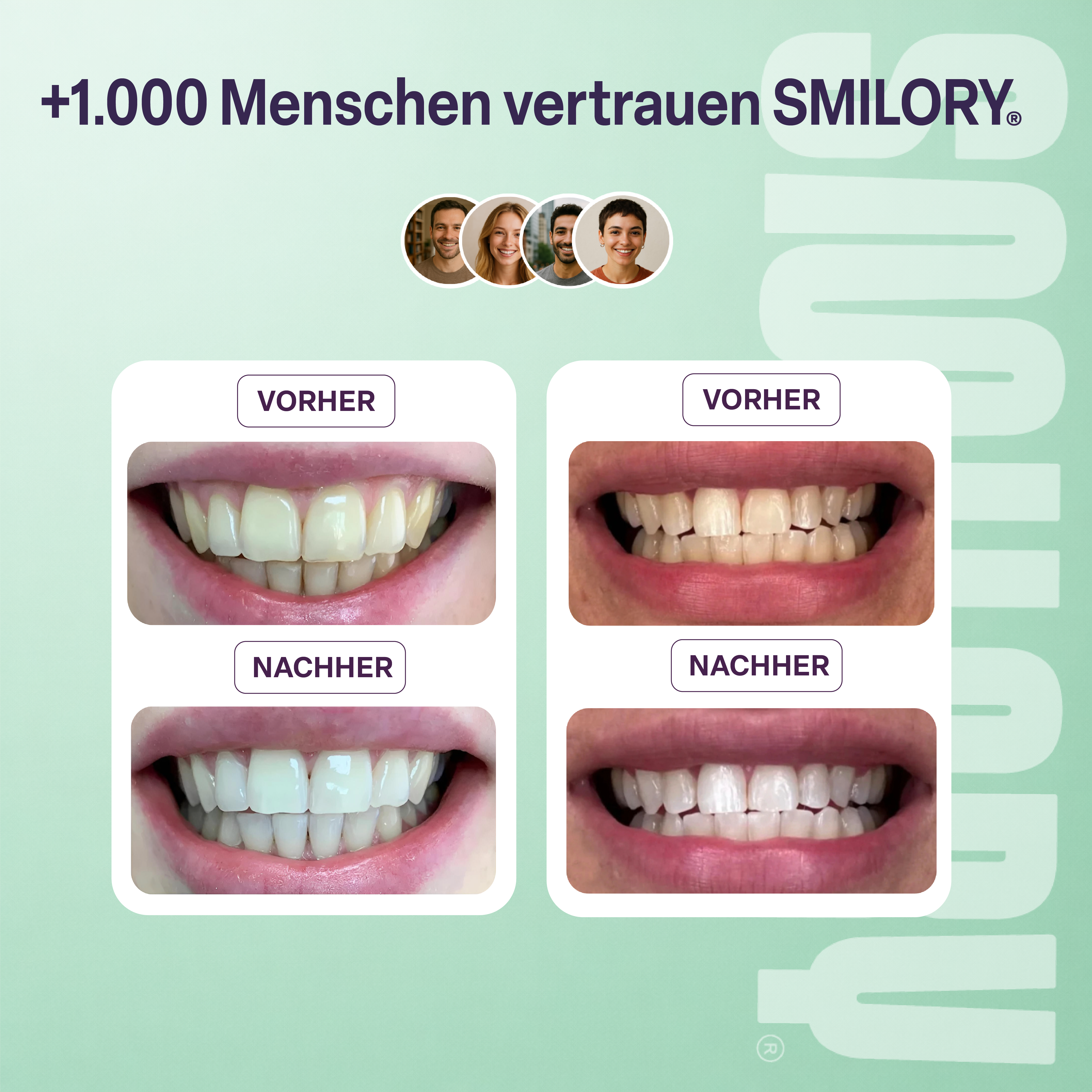 Zahnaufhellungspulver - SMILORY®