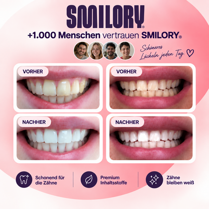 Smilory® Zahnaufhellungsstreifen, packung mit vier Streifen, für hellere Zähne und ein strahlendes Lächeln, auf weißem Hintergrund