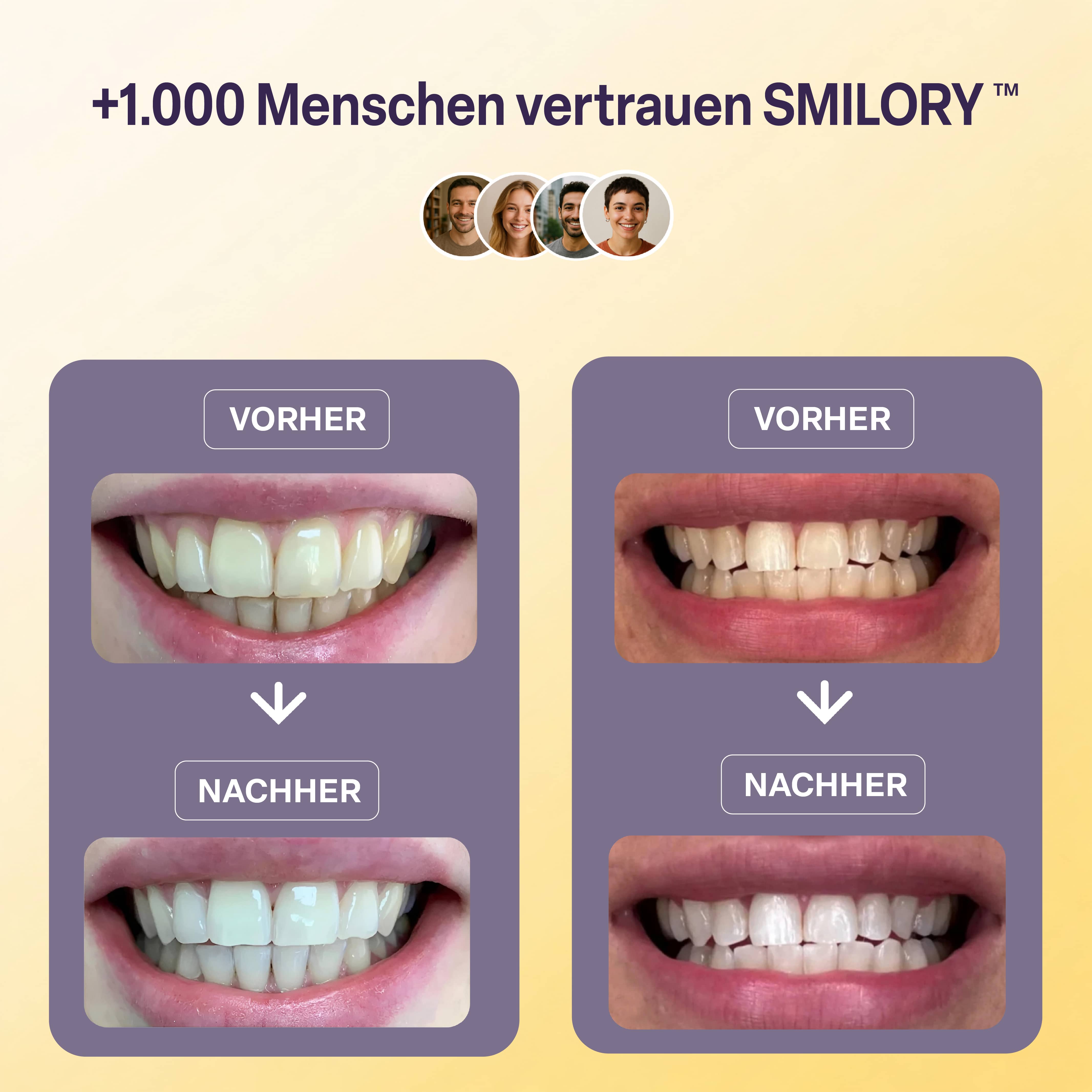 Zahnaufhellungsstreifen