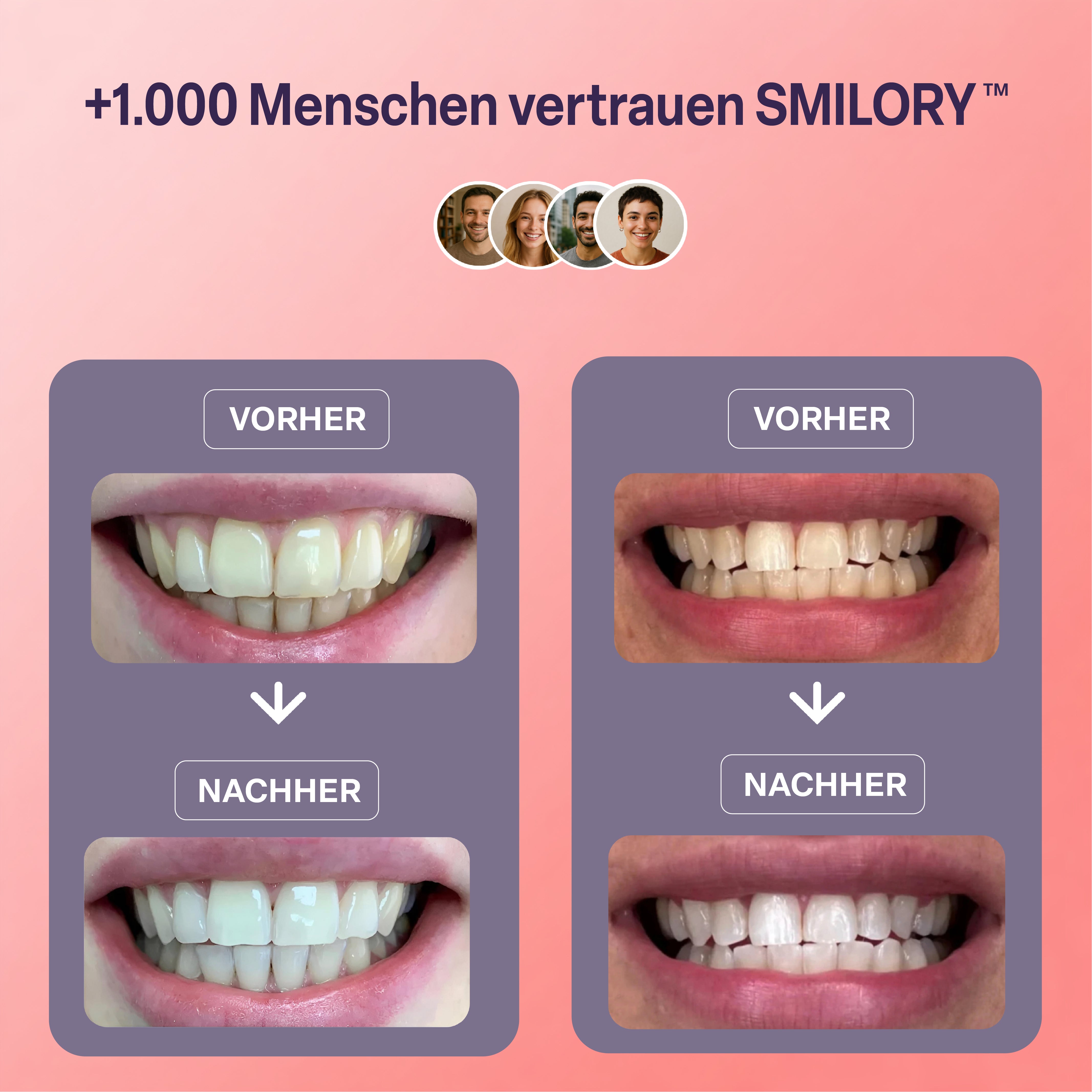 Zahnaufhellungsstreifen