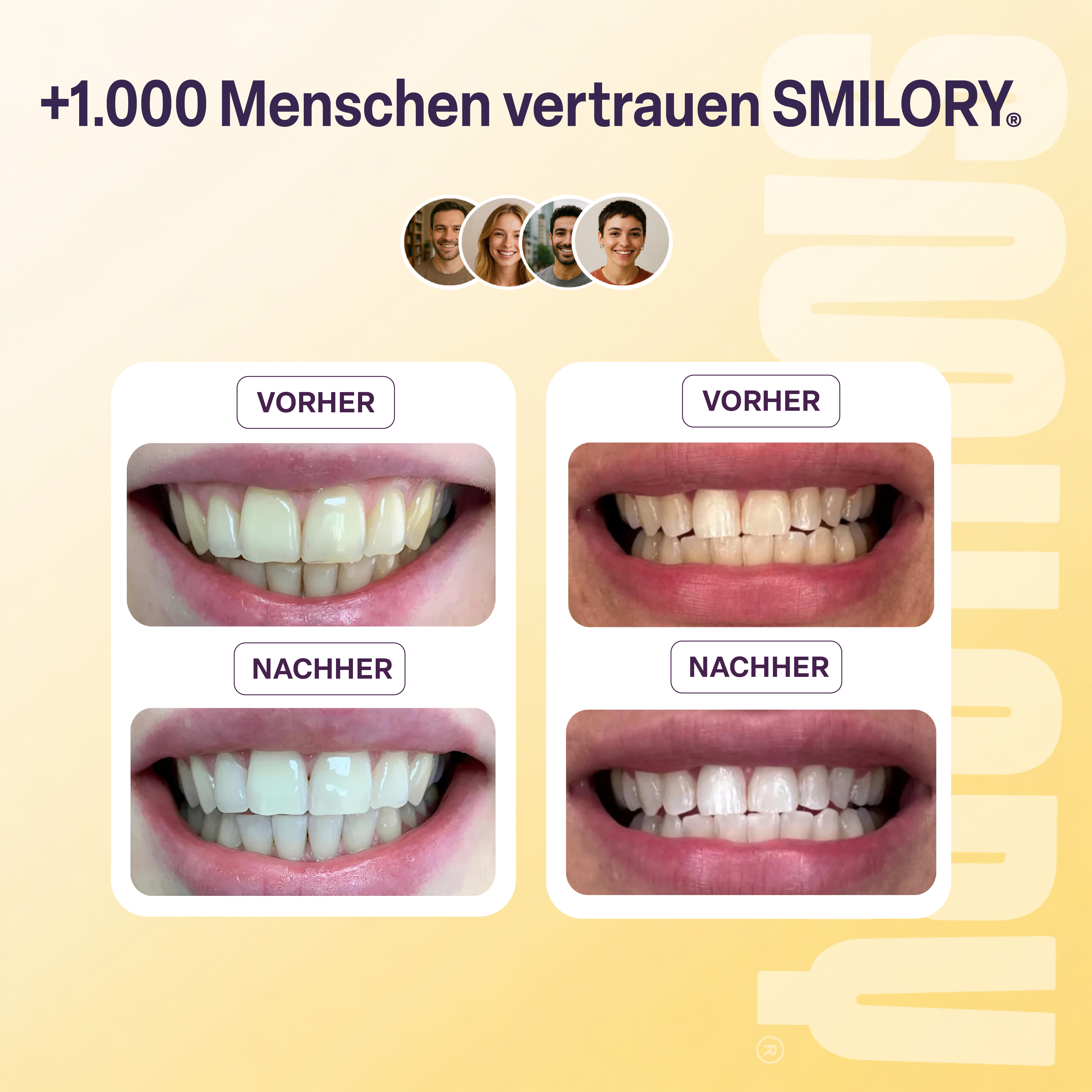 Zahnaufhellungspulver - SMILORY®
