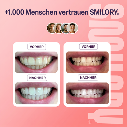 Zahnaufhellungsstreifen - SMILORY®