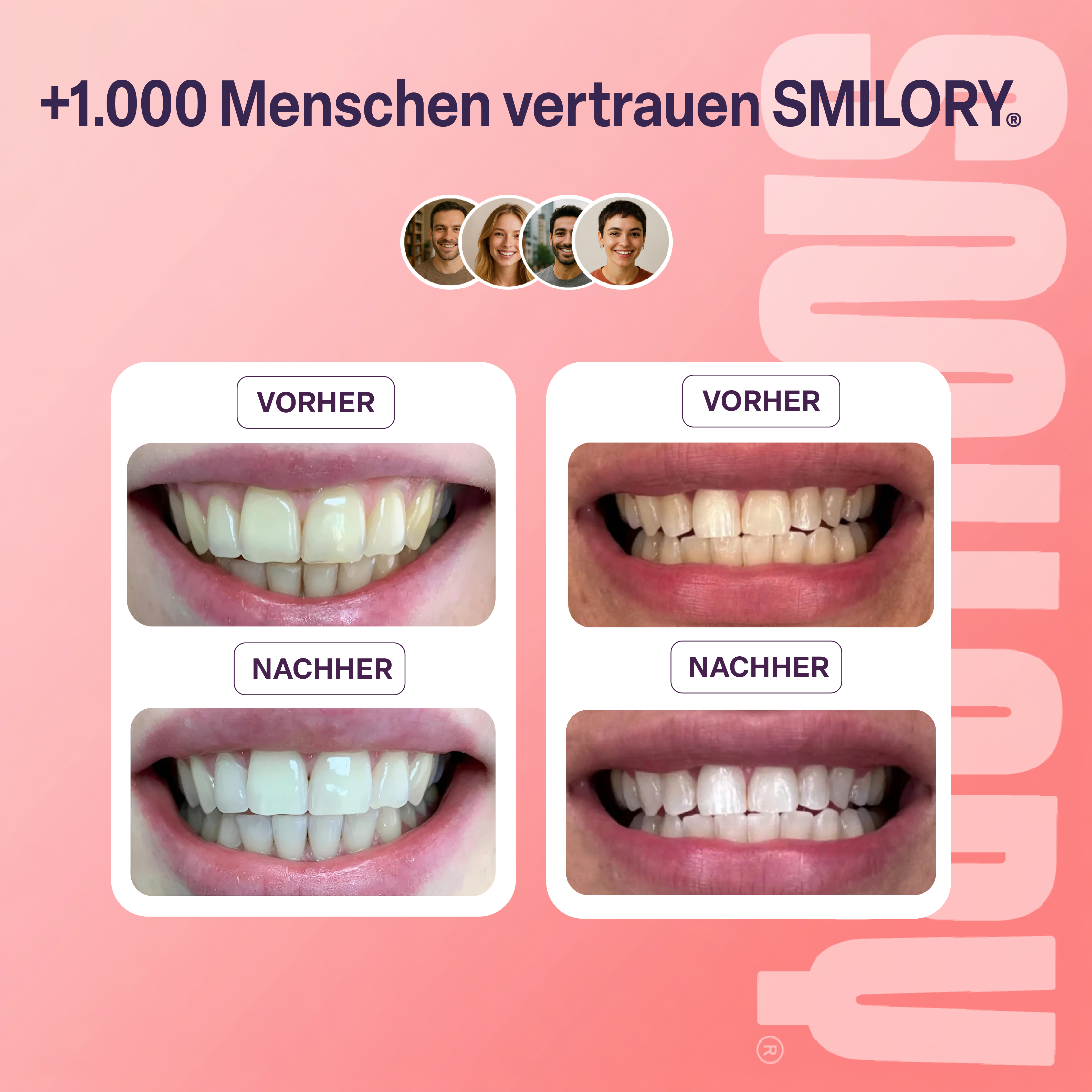 Zahnaufhellungsstreifen - SMILORY®