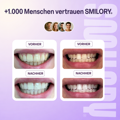 Lila Zahnpasta - SMILORY®