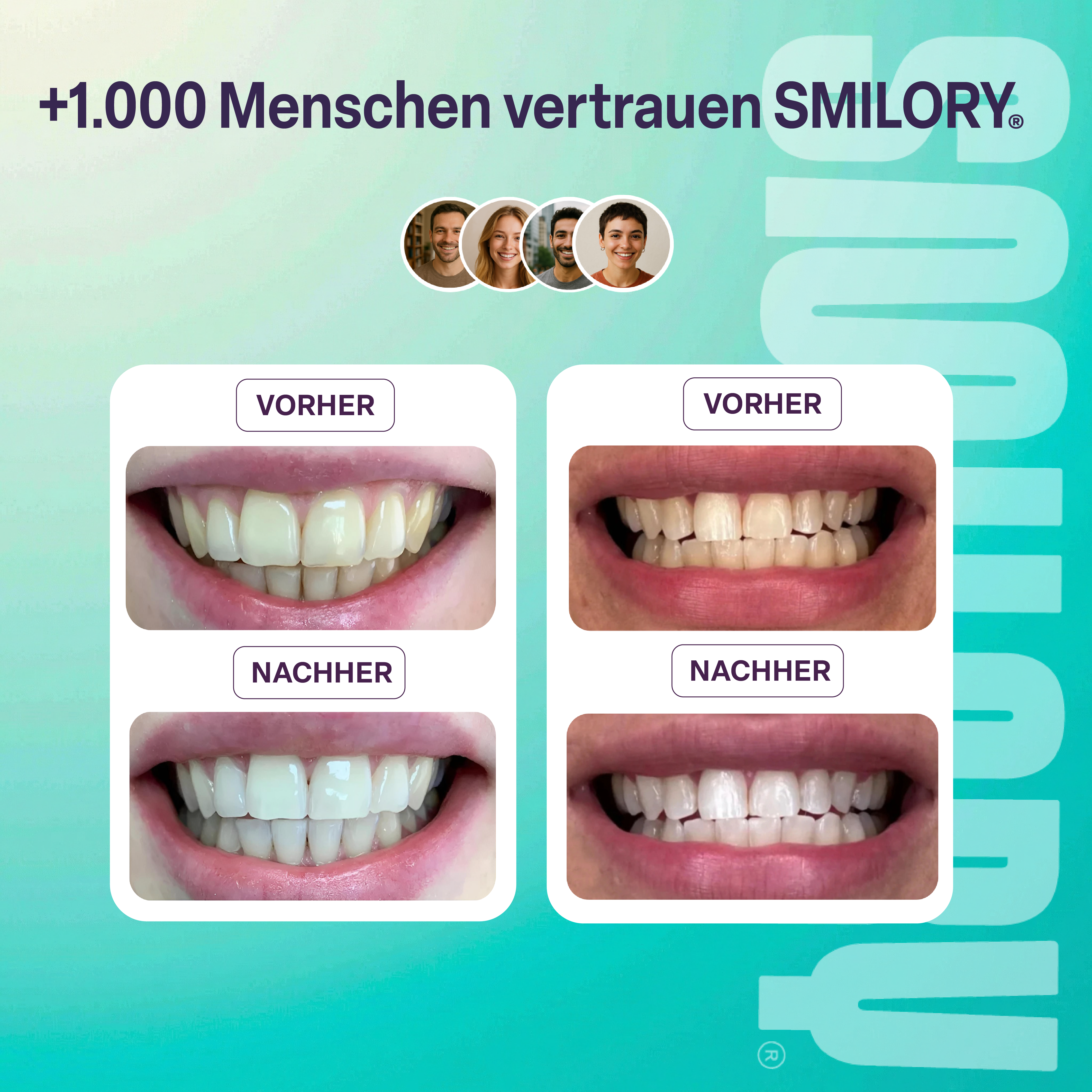 Zahnaufhellungsset - SMILORY®